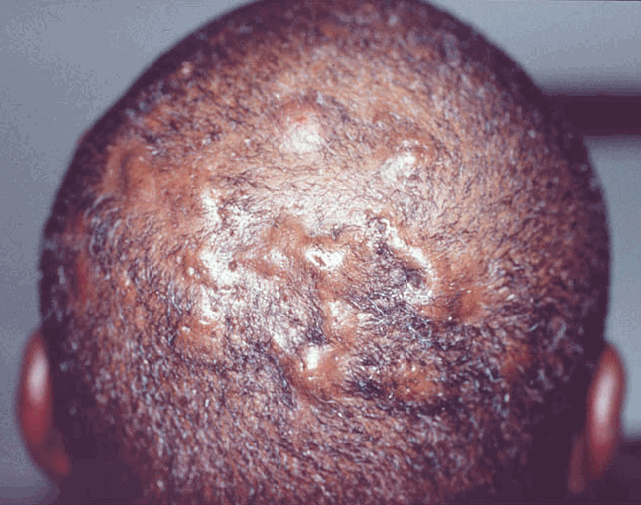 Top prescription weight loss medications image 5